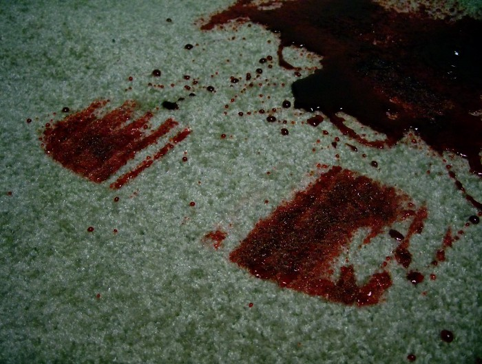 How To Remove Blood Stains Out of Your Carpet
